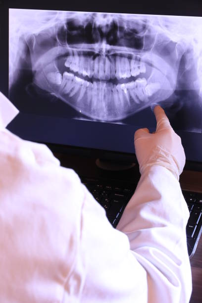 Best Root Canal Emergency Dentist  in Rockport, IN